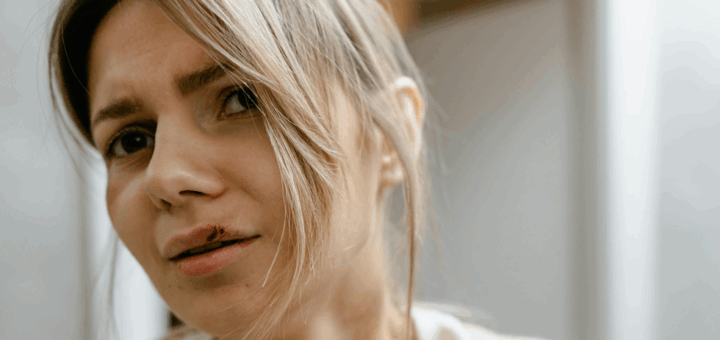 Aline Herpes